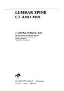 Lumbar Spine Ct and Mri J. George Teplick