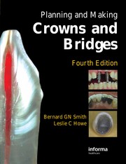 Planning and making crowns and bridges by Bernard G. N. Smith