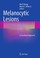 Cover of: Melanocytic Lesions