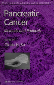 Pancreatic cancer by Gloria H. Su