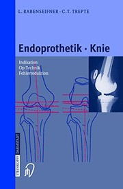 Cover of: Endoprothetik Knie