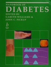 Cover of: Handbook of Diabetes
