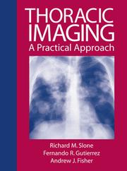 Cover of: Review of Thoraic Imaging and Chest Disease by Richard M. Slone, Fernando Guitierrez