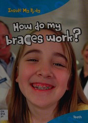 How do braces work? by Steve Parker