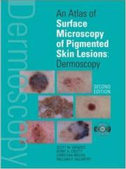 Cover of: An Atlas of Surface Microscopy of Pigmented Skin Lesions: Dermoscopy,  Second Edition