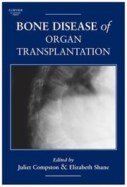Cover of: Bone Disease of Organ Transplantation | 