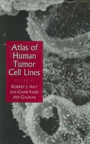 Cover of: Atlas of human tumor cell lines