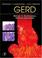 Cover of: GERD