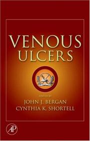 Venous ulcers