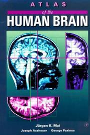Cover of: Atlas of the human brain by Jürgen K. Mai