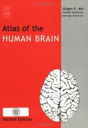 Cover of: Atlas of the Human Brain, Second Edition by Juergen K. Mai, George Paxinos, Joseph K. Assheuer