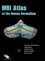 Cover of: MRI Atlas of the Human Cerebellum (Book with CD-ROM for Windows & Macintosh)