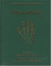 Cover of: Osteoarthritis by edited by Kenneth D. Brandt, Michael Doherty, and L. Stefan Lohmander.