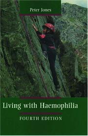 Cover of: Living with haemophilia