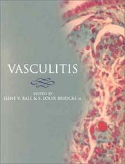 Cover of: Vasculitis