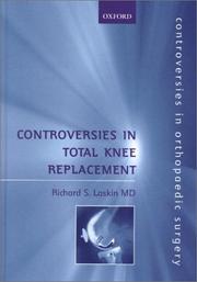 Cover of: Controversies in total knee replacement