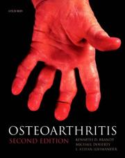 Cover of: Osteoarthritis by edited by Kenneth D. Brandt, Michael Doherty, and L. Stefan Lohmander.