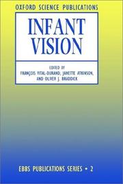 Cover of: Infant vision