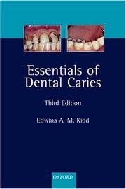 Cover of: Essentials of Dental Caries by Edwina A. M. Kidd