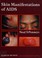 Cover of: Skin manifestations of AIDS