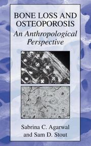 Cover of: Bone Loss and Osteoporosis: An Anthropological Perspective