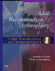 Adult reconstruction & arthroplasty