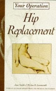 Cover of: Hip Replacement (Your Operation) by Ian D. Learmonth, Jane Smith