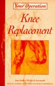 Cover of: Knee Replacement (Your Operation) by Ian D. Learmonth, Jane Smith, Ian D. Learmonth, Jane Smith