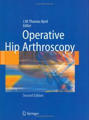 Cover of: Operative Hip Arthroscopy