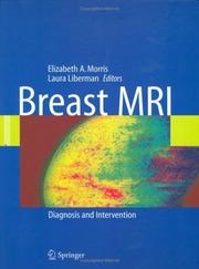 Cover of: Breast MRI by 