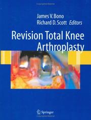 Cover of: Revision Total Knee Arthroplasty by 