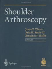 Cover of: Shoulder Arthroscopy by 