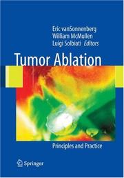 Cover of: Tumor Ablation: Principles and Practice