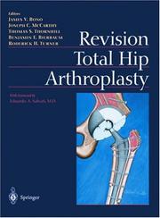 Revision total hip arthroplasty by James V. Bono