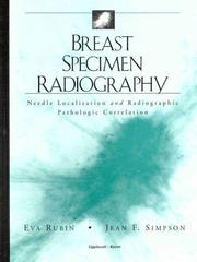 Cover of: Breast specimen radiography: needle localization and radiographic pathologic correlation