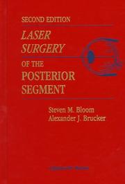 Laser surgery of the posterior segment