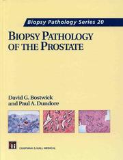 Cover of: Biopsy pathology of prostate