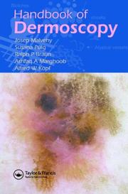 Cover of: Handbook of Dermoscopy