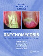 Cover of: Onychomycosis, Second Edition (Dermatological Treatment) by 