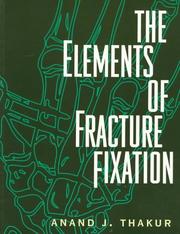 Cover of: The elements of fracture fixation by A. J. Thakur