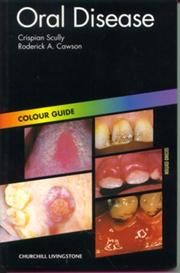 Cover of: Oral disease by Crispian Scully