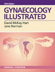 Cover of: Gynaecology Illustrated 5/e | David McKay Hart