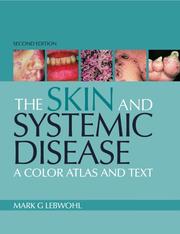 Cover of: Atlas of the Skin and Systemic Disease