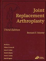 Cover of: Joint Replacement Arthroplasty