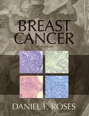 Cover of: Breast Cancer