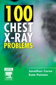 Cover of: 100 Chest X-Ray Problems by Jonathan Corne, Kate Pointon