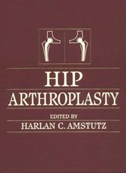 Cover of: Hip arthroplasty