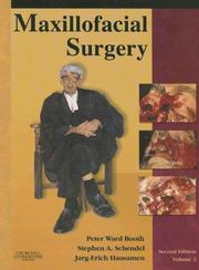Cover of: Maxillofacial Surgery | Peter Ward Booth