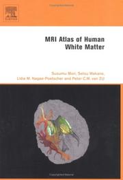Cover of: MRI atlas of human white matter | S. Mori