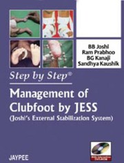 Cover of: Management of Clubfoot by Jess (Joshi's External Stabilization System)